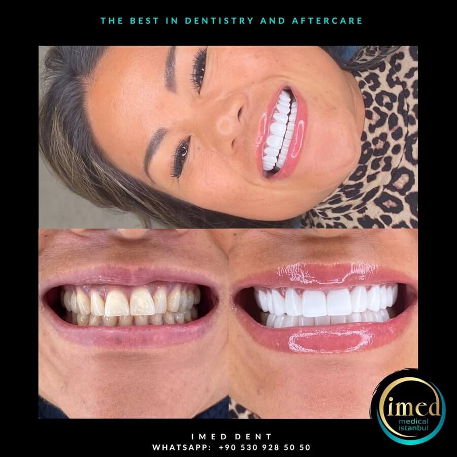 iMed Dent