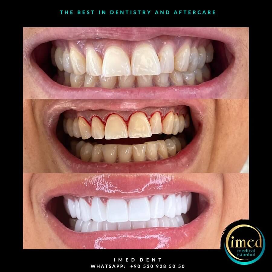 iMed Dent