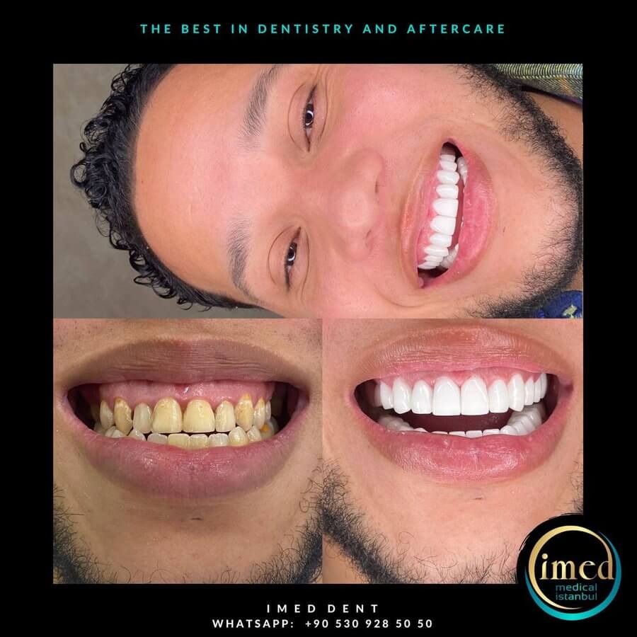 iMed Dent