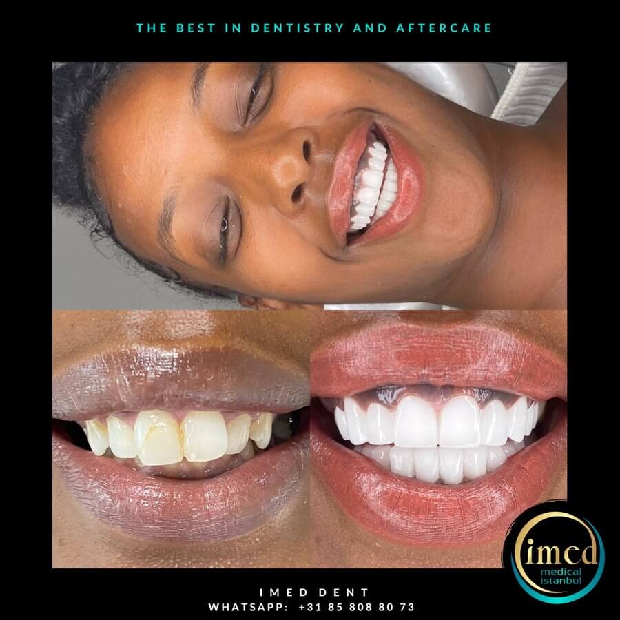 iMed Dent