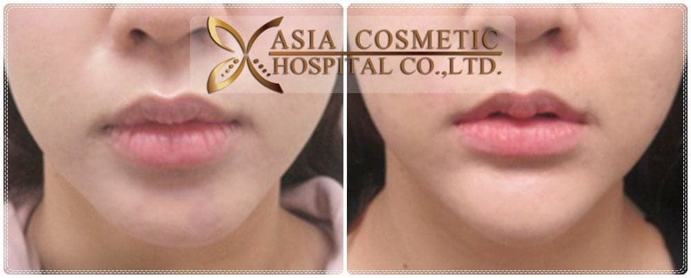 Asia Cosmetic Hospital