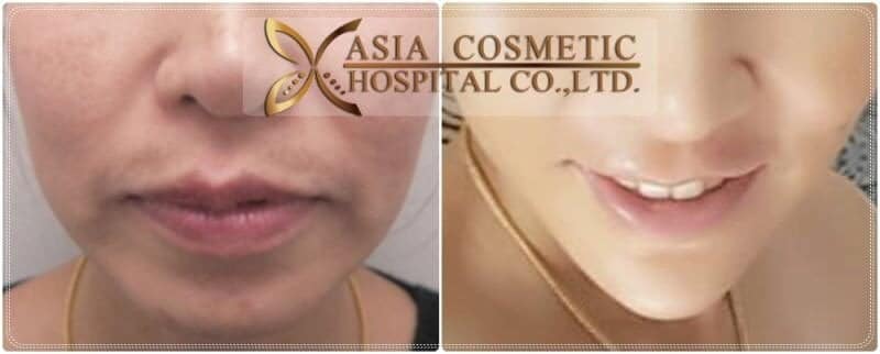 Asia Cosmetic Hospital