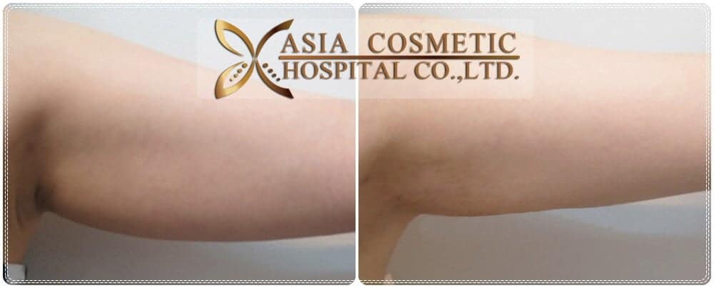 Asia Cosmetic Hospital