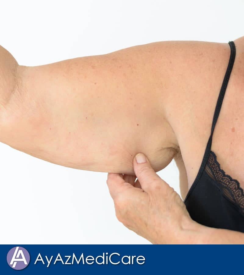 AyAz MediCare