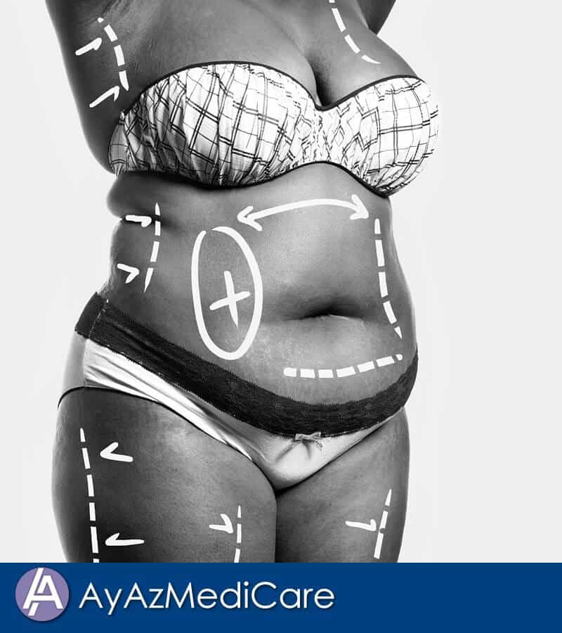 AyAz MediCare