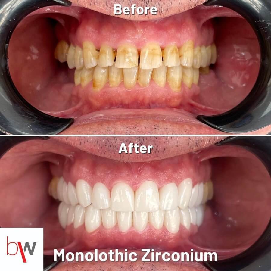 BeWell Health Assistance Dental