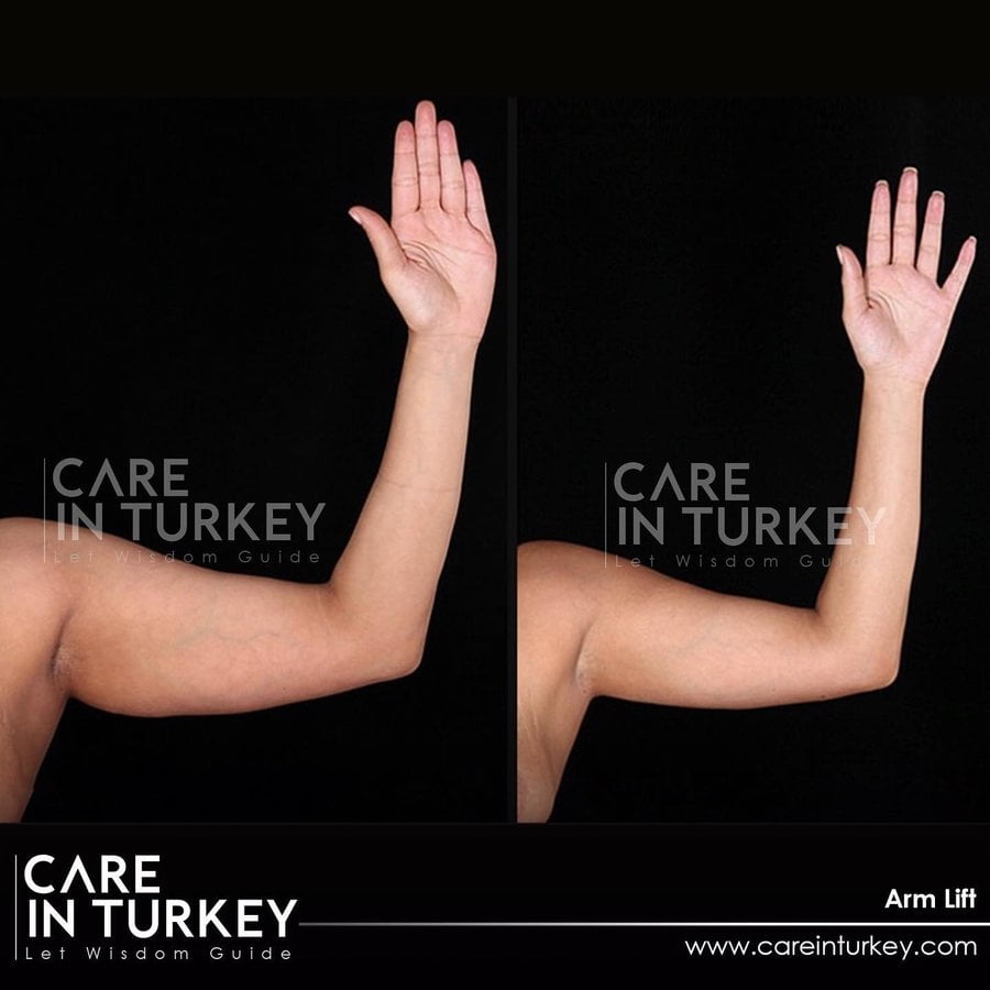 Care in Turkey