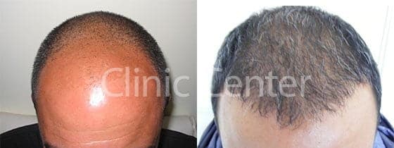Clinic Center - Hair Transplant Clinic Turkey