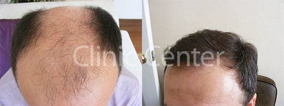 Clinic Center - Hair Transplant Clinic Turkey