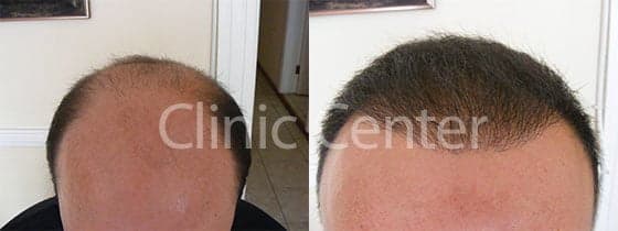 Clinic Center - Hair Transplant Clinic Turkey
