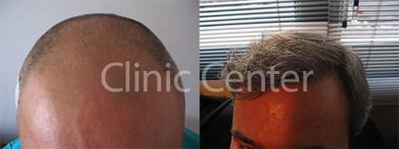 Clinic Center - Hair Transplant Clinic Turkey