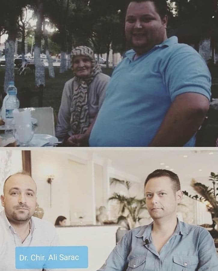 Clinic Mono Bariatric Surgery Centre