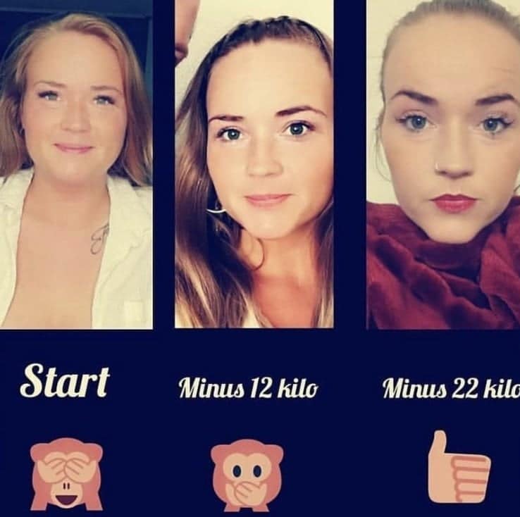 Clinic Mono Bariatric Surgery Centre