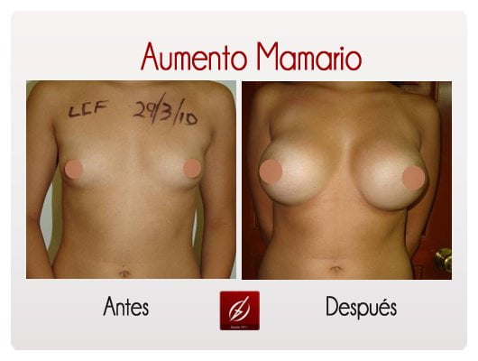 Clínica Láser Puebla