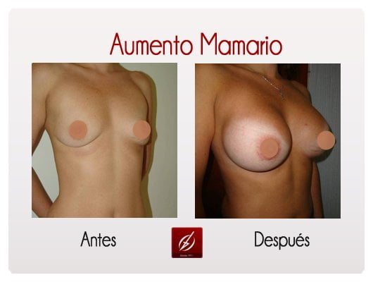 Clínica Láser Puebla