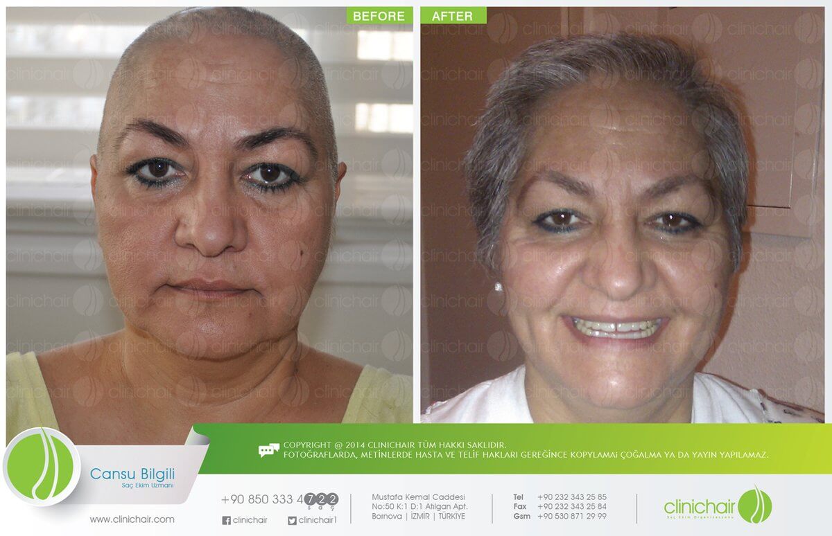 ClinicTurkey