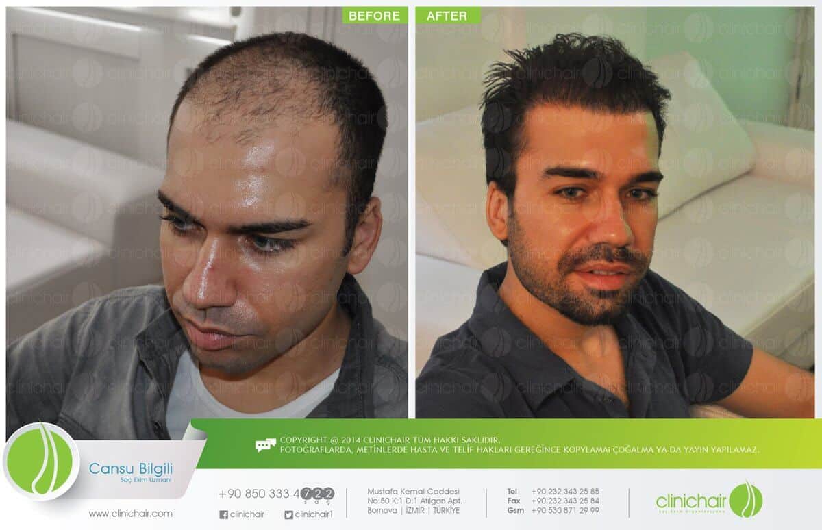 ClinicTurkey