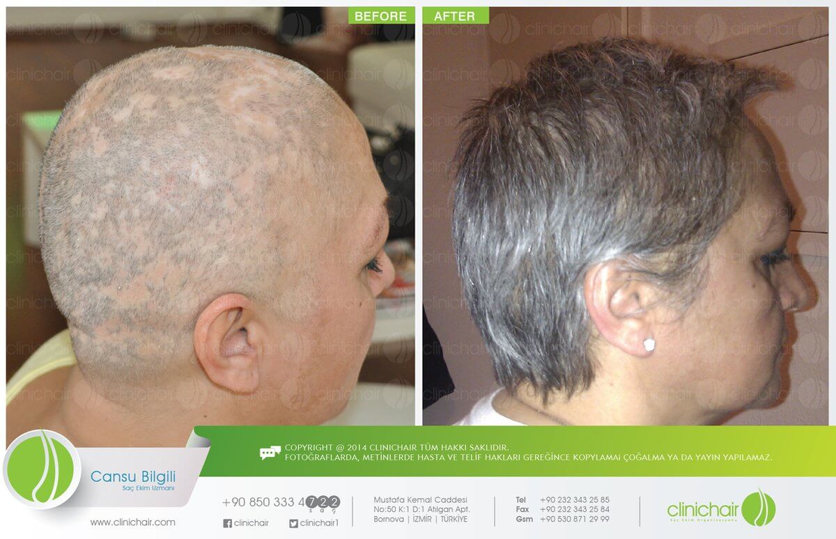 ClinicTurkey
