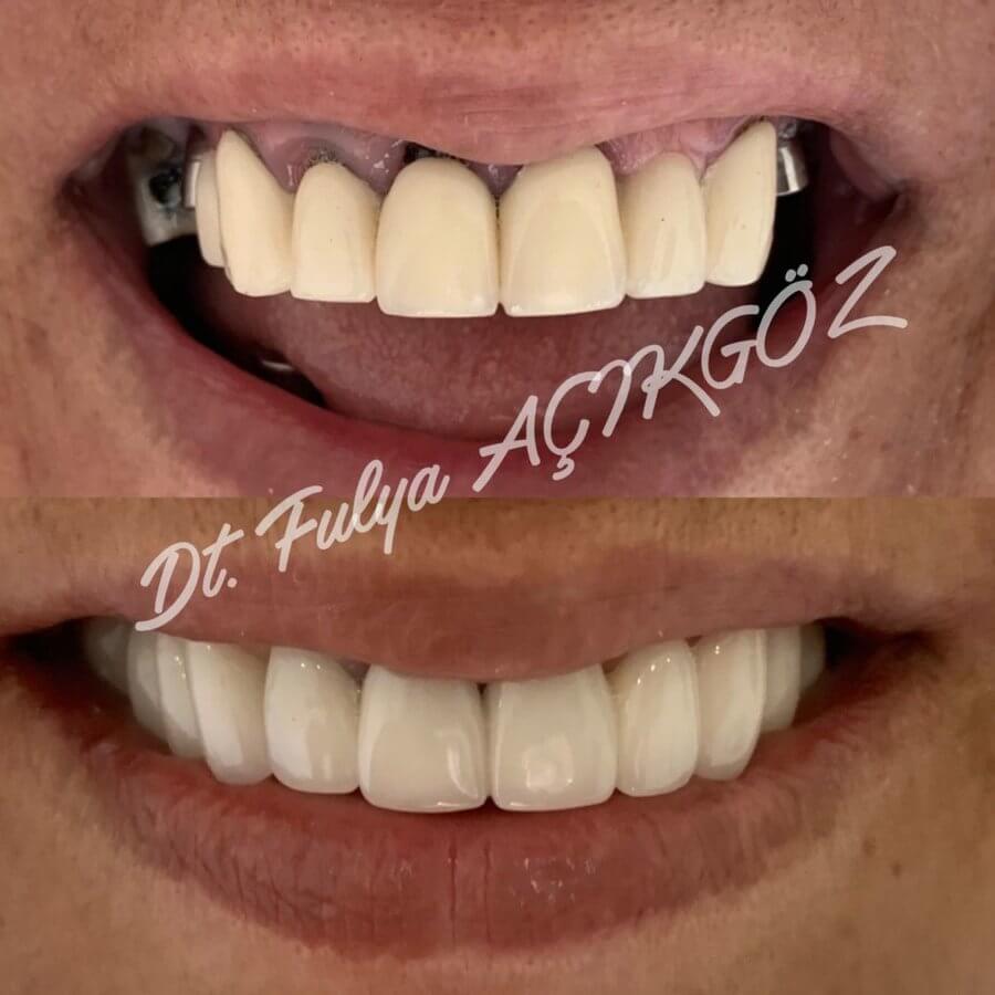 Cosmetic Dentists of Istanbul