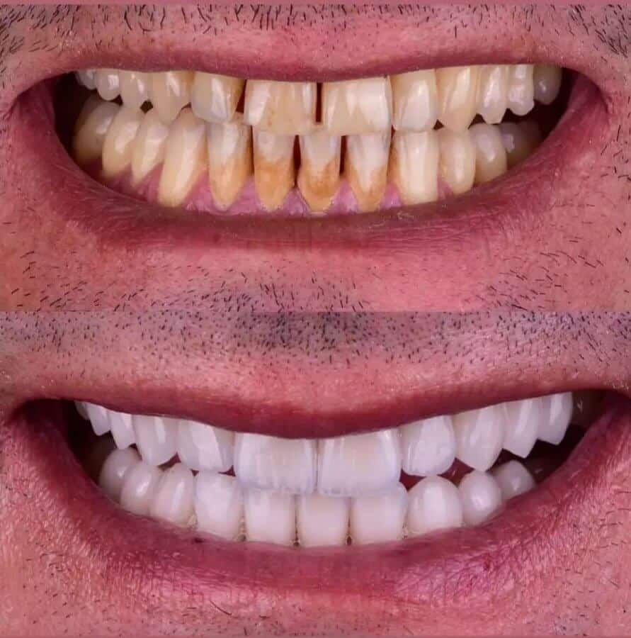 Cosmetic Dentists of Istanbul