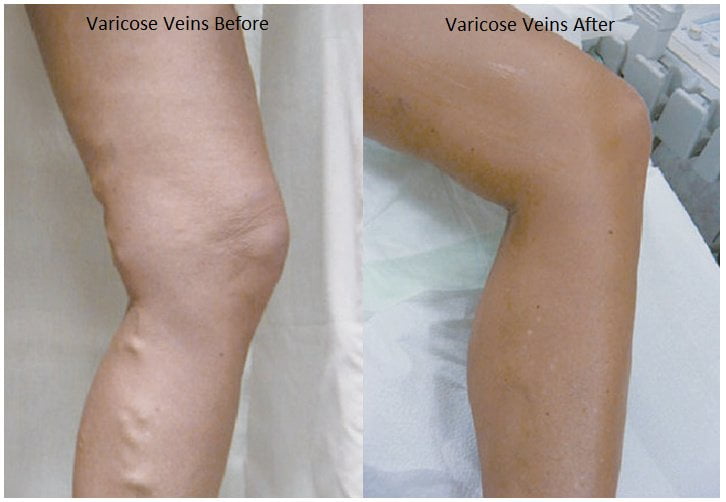 Crows Nest Cosmetic and Vein Clinic