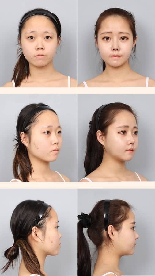 DA Plastic Surgery Clinic Korea