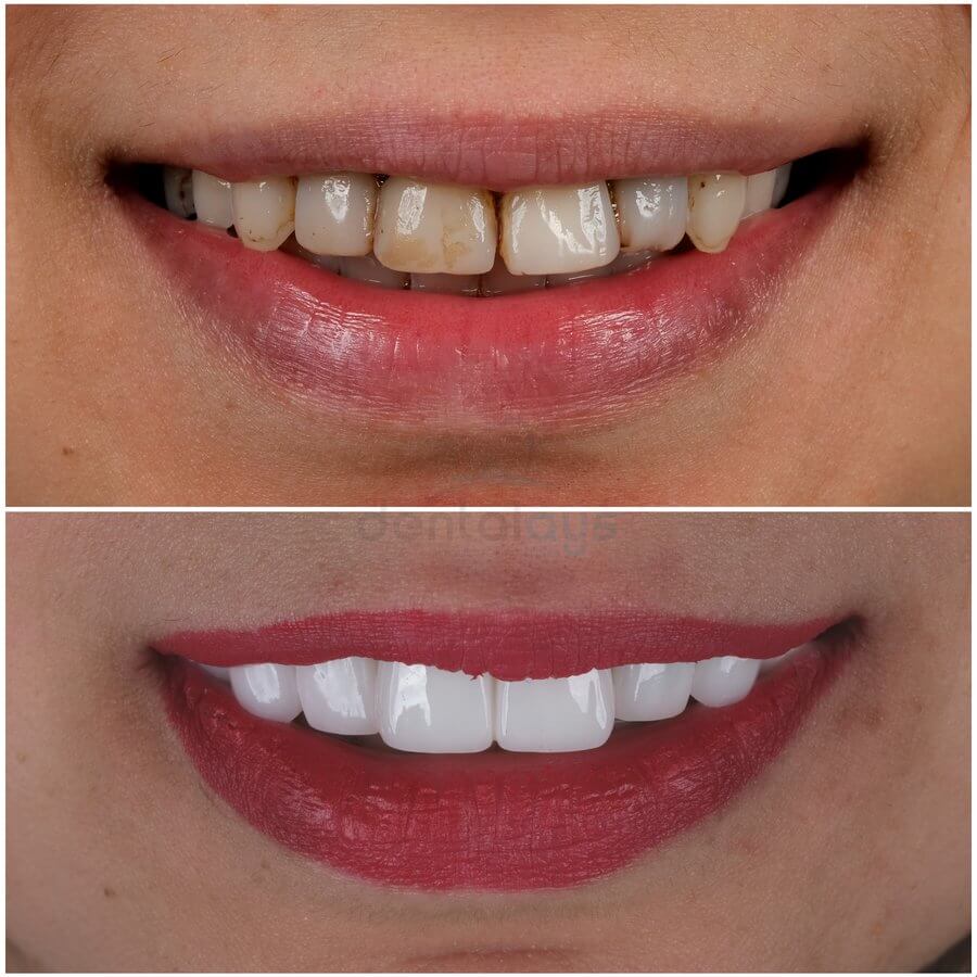 DentalAYS Dental Center