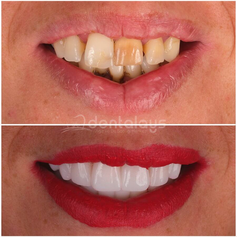 DentalAYS Dental Center