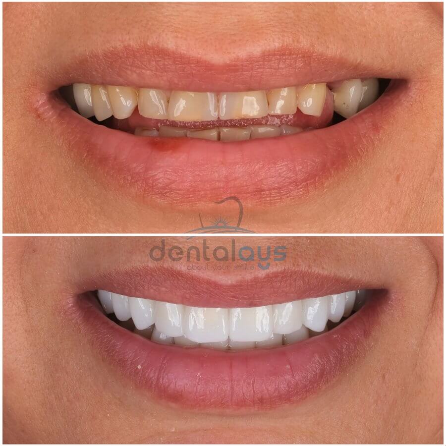 DentalAYS Dental Center