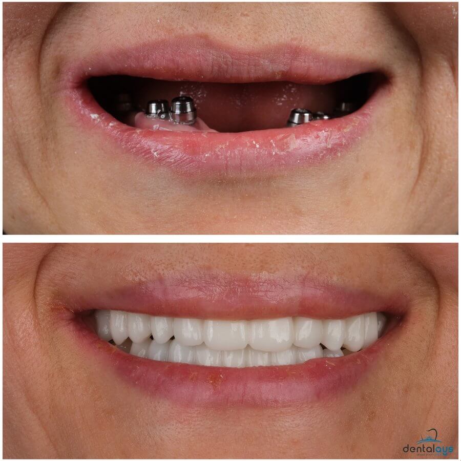 DentalAYS Dental Center