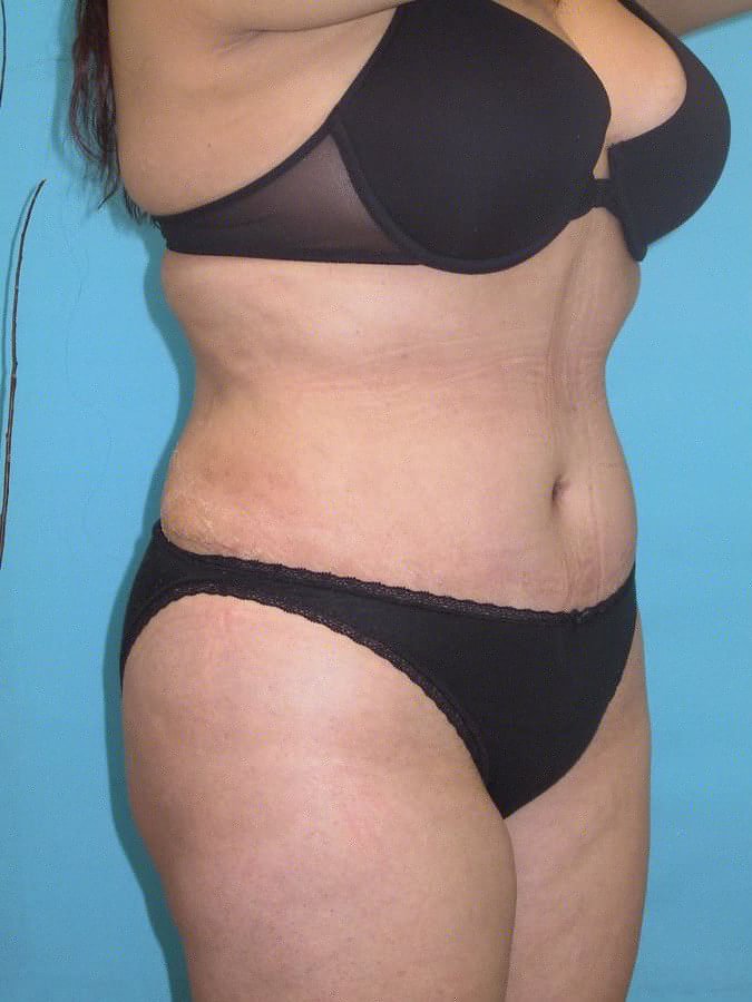Dr. Victor Gutierrez Plastic Surgical Clinic