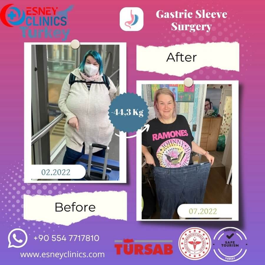Esney Health Tourism