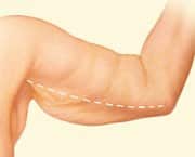 Esteurope-Aesthetic Surgery-Obesity Surgery