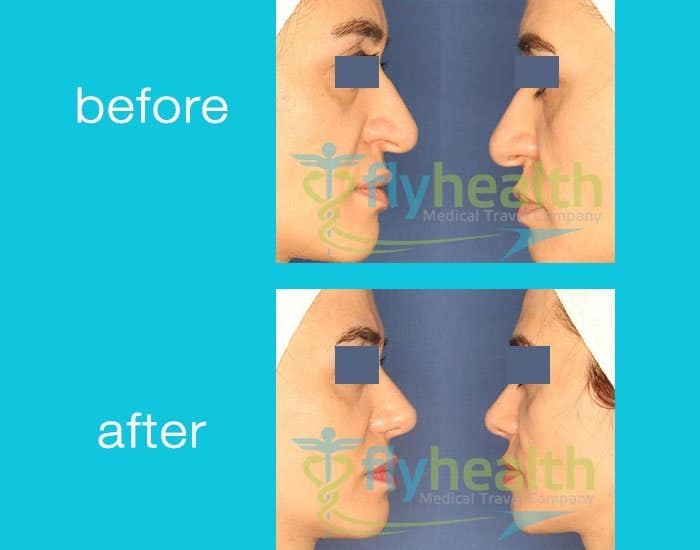 FlyHealth