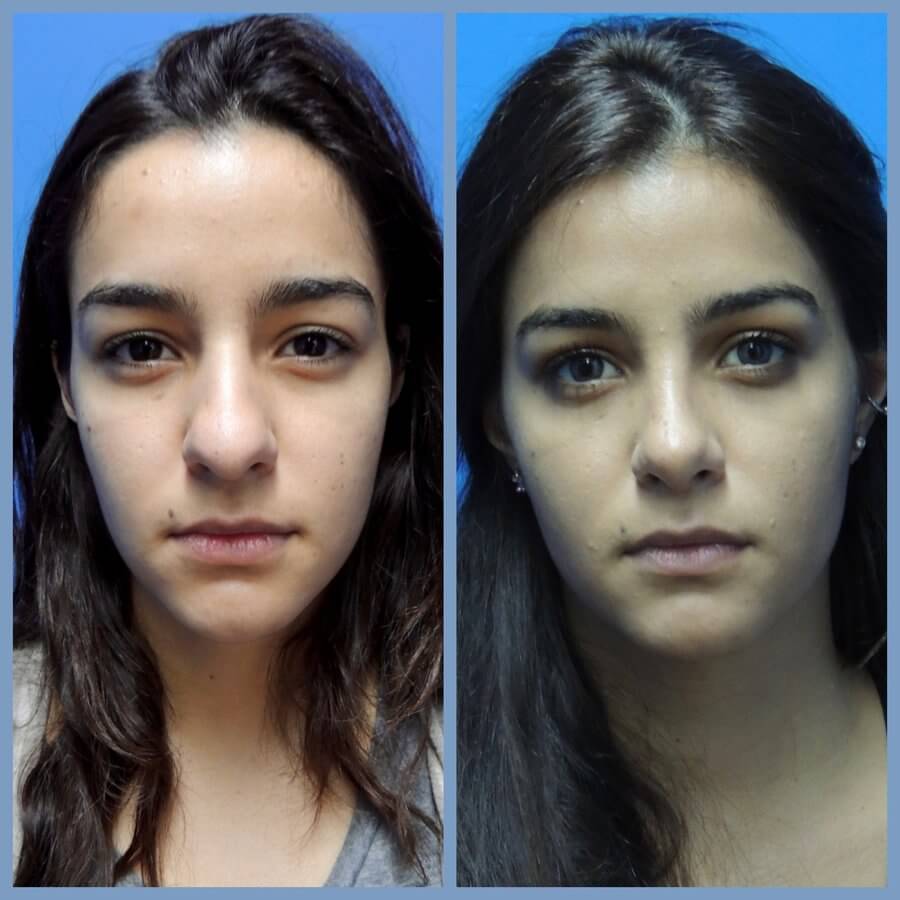 Gilmont Plastic Surgery