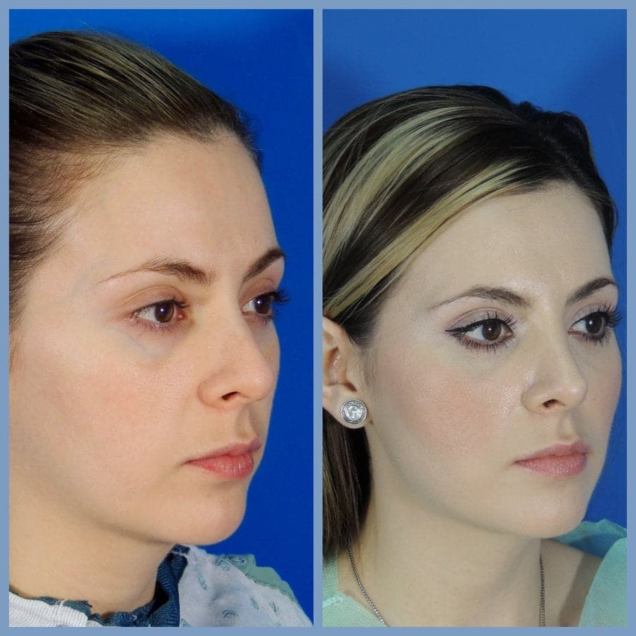 Gilmont Plastic Surgery