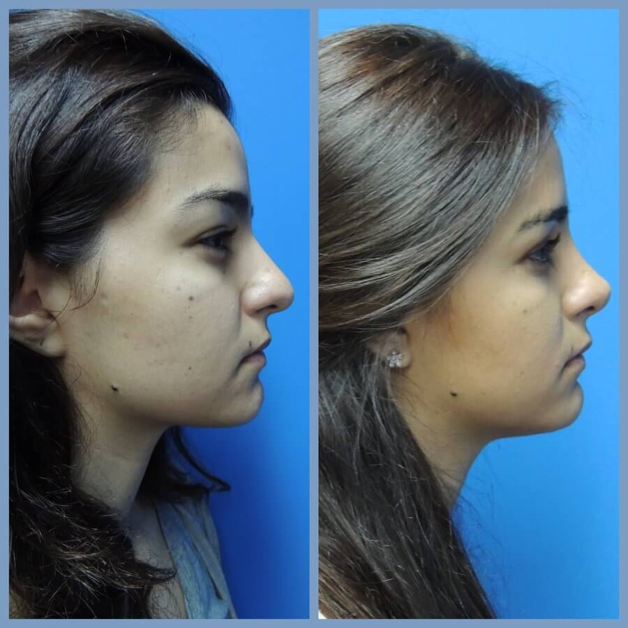 Gilmont Plastic Surgery