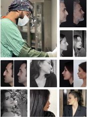 medicaways harun acipayam rhinoplasty clinic 3 Listings