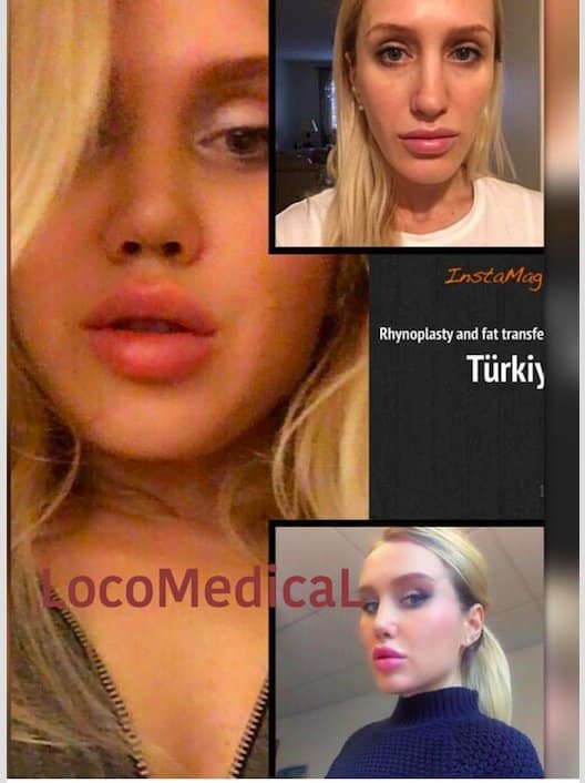 Loco Medical