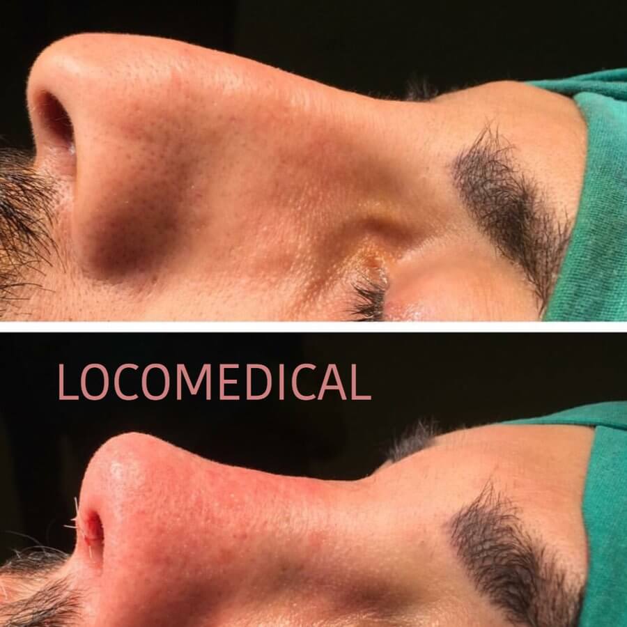 Loco Medical