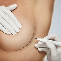 Mark Ho-Asjoe Consultant Plastic Surgeon