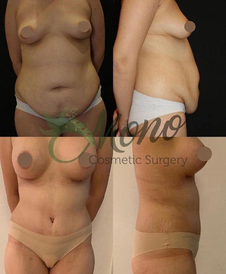 Mono Cosmetic Surgery Center