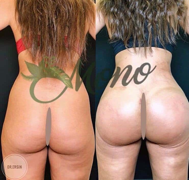 Mono Cosmetic Surgery Center