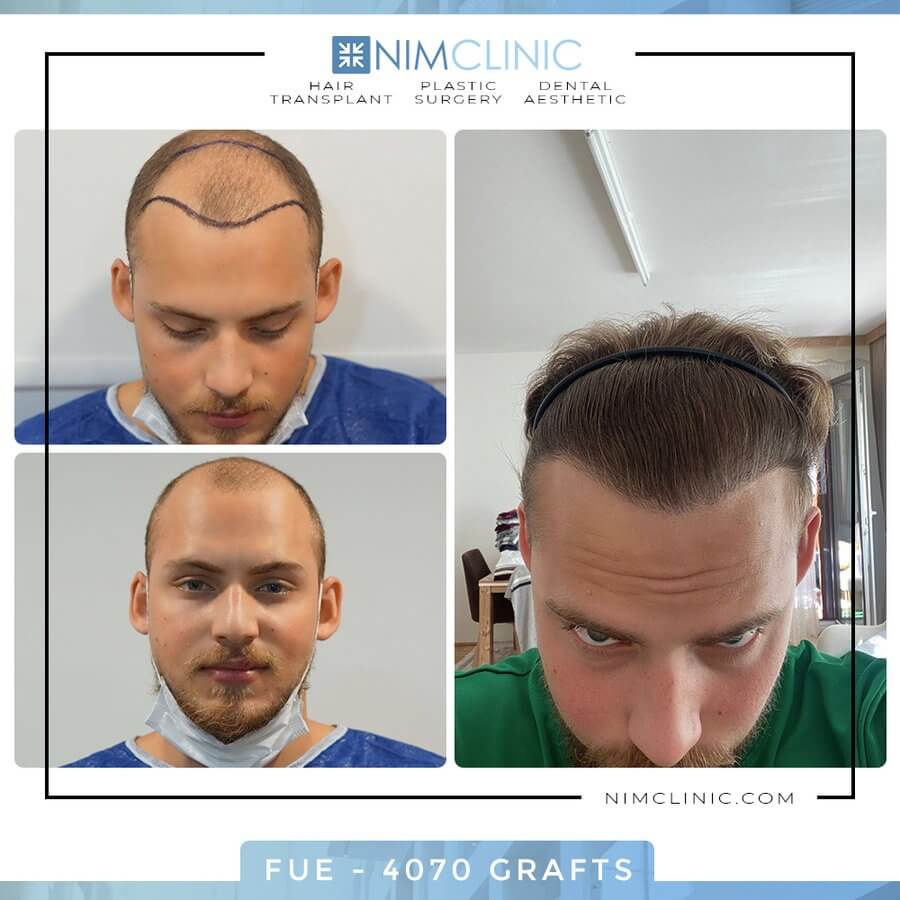 Nimclinic