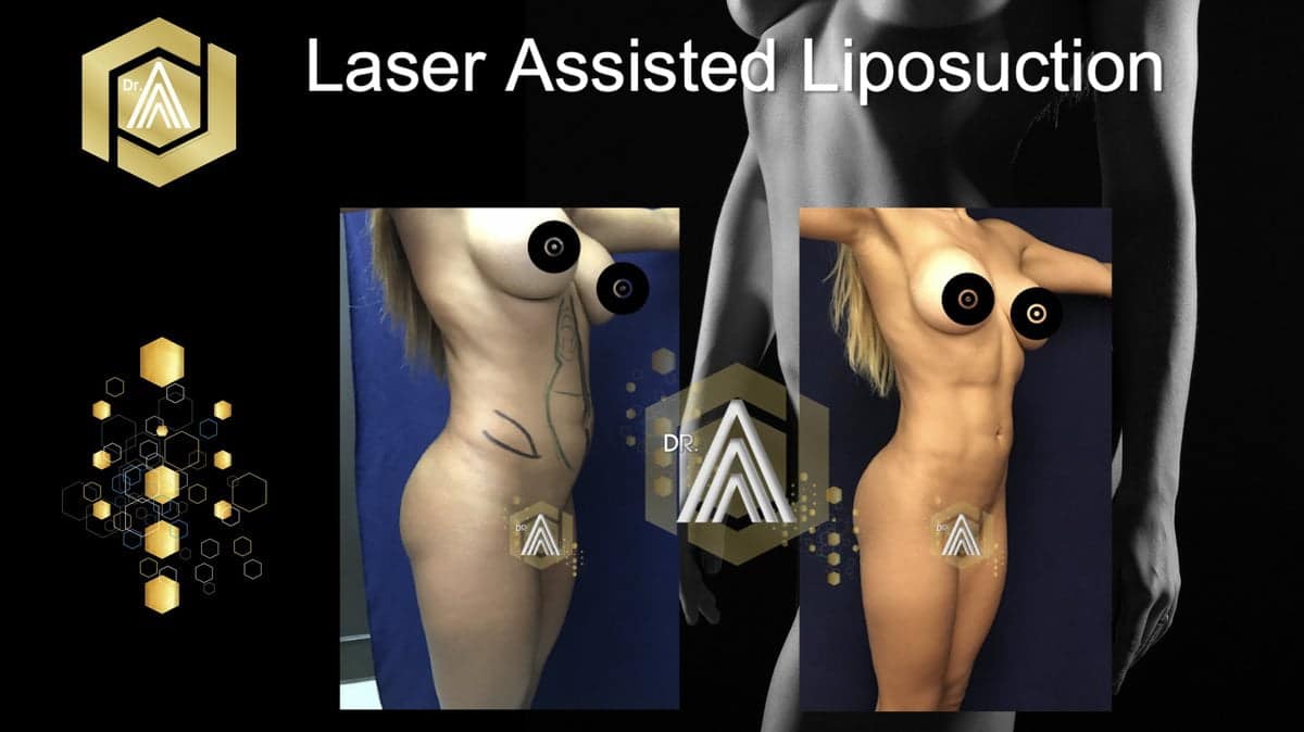 Treatment for Lines & Wrinkles Center - Dr. Avalos