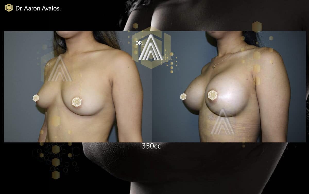 Treatment for Lines & Wrinkles Center - Dr. Avalos
