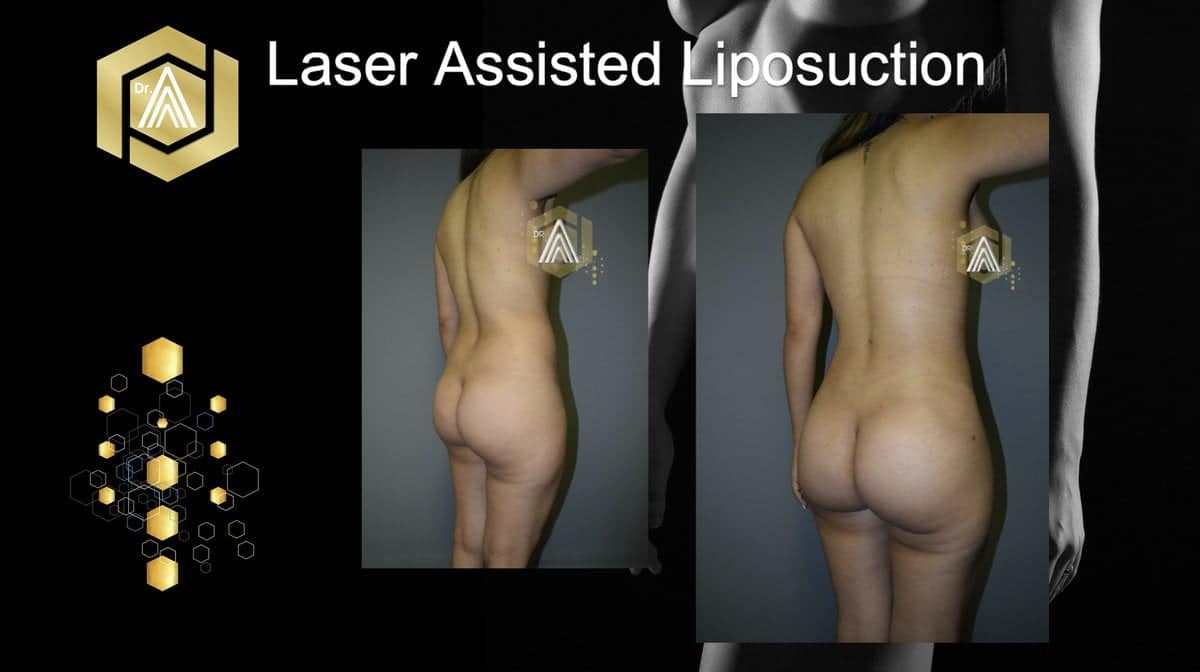 Treatment for Lines & Wrinkles Center - Dr. Avalos