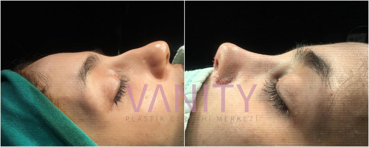 Vanity Cosmetic Surgery Hospital İstanbul