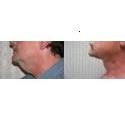 Celestial Institute of Plastic Surgery - Mohamad H. Bazzi MD.