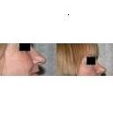 Celestial Institute of Plastic Surgery - Mohamad H. Bazzi MD.